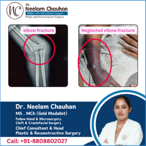 patient education (4)